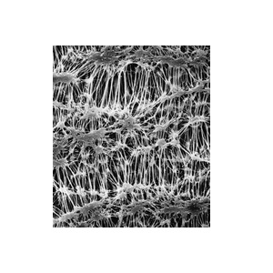 OMNIPORE MEMBRANE FILTER
